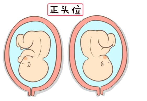 不長妊娠紋的孕媽都有這幾個特征，你中了嗎？